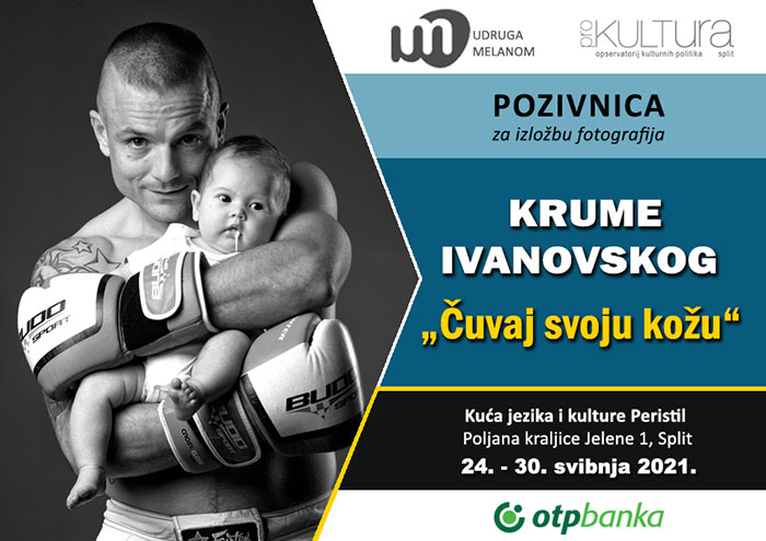 Izložba ”Čuvaj svoju kožu” u Kući jezika i kulture Peristil