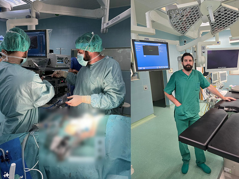 Liječnici KBC-a Split prvi u Hrvatskoj izveli laparoskopsko uklanjanje cijelog želuca