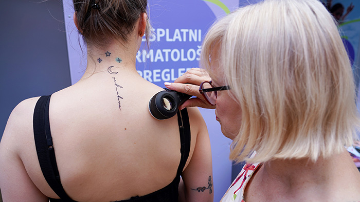 U petak u Splitu besplatno pregledajte kožu i savjetujte se sa stručnjacima
