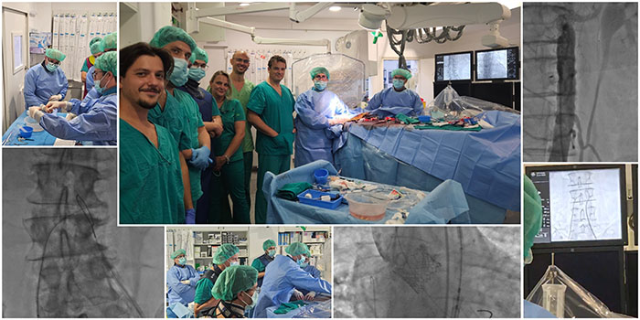 Splitska kardiologija ponovno oduševljava: novo dostignuće u intervencijskom liječenju  strukturne bolesti srca